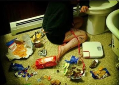Dg: Bulimia nervosa