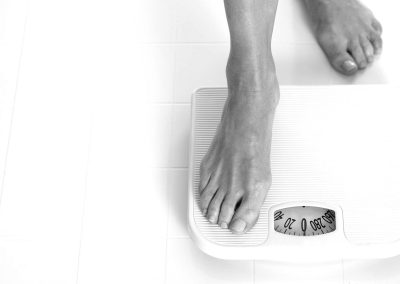Dg: Anorexia nervosa, restriktivni tip